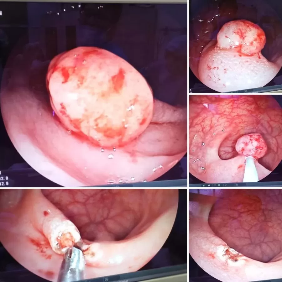 Dr. Neil Palkhiwala MD DM MRCP - Interventional Gastro and Hepatologist - Photo 6