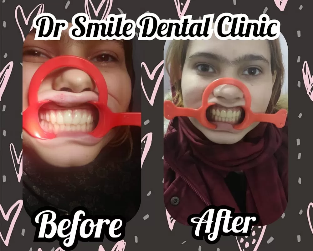 Dr smile Dental Clinic - Photo 4