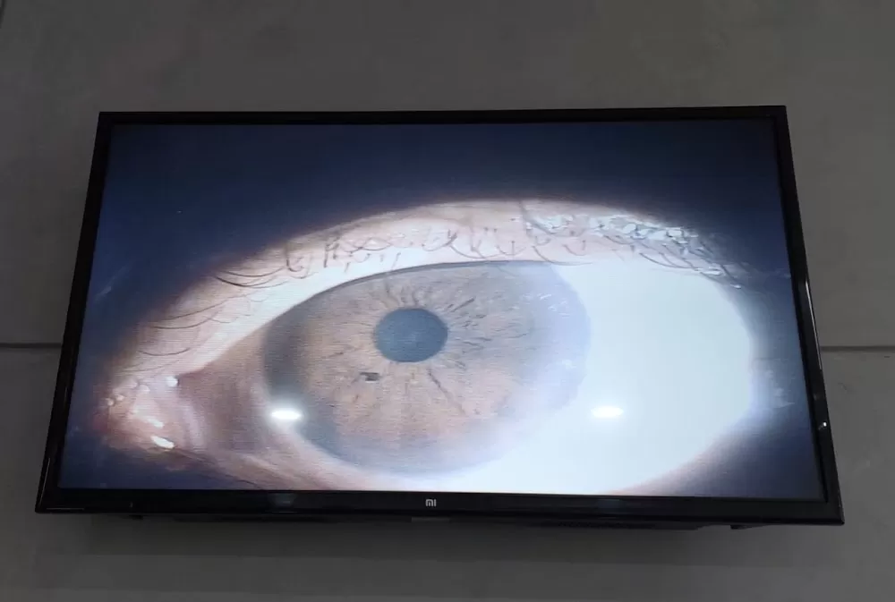 SHARDA EYE HOSPITAL - Dr Manish Joshi - Photo 6