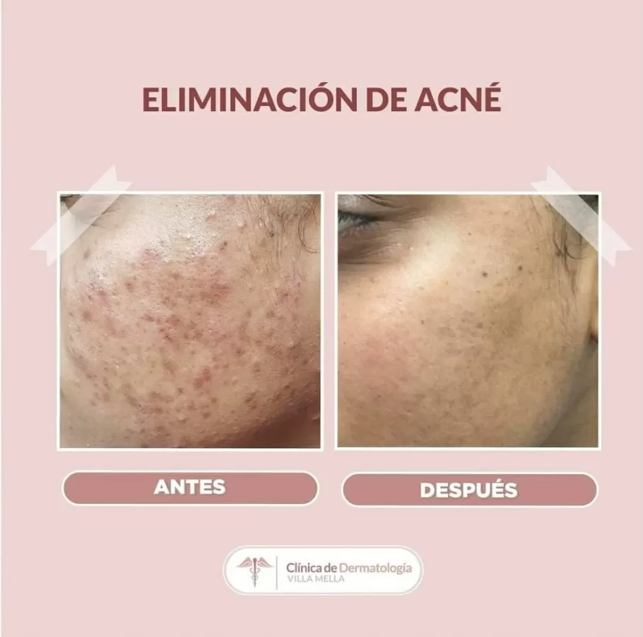 Clínica de Dermatología Villa Mella - Photo 4