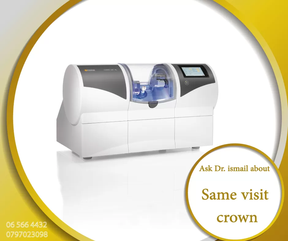 Alsalem Dental & Implant Center - Photo 5