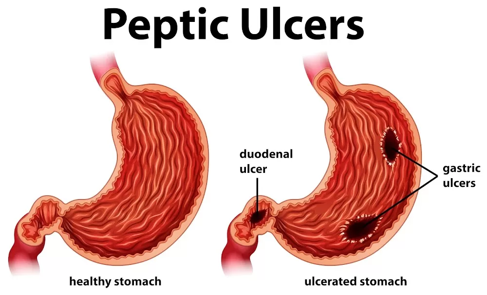 Dr Vijay Kumar H J-Consult With Best Gastroenterologist Doctor Near Me . - Photo 2