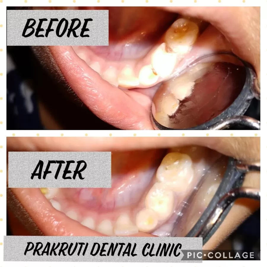 Prakruti Dental Clinic - Photo 5