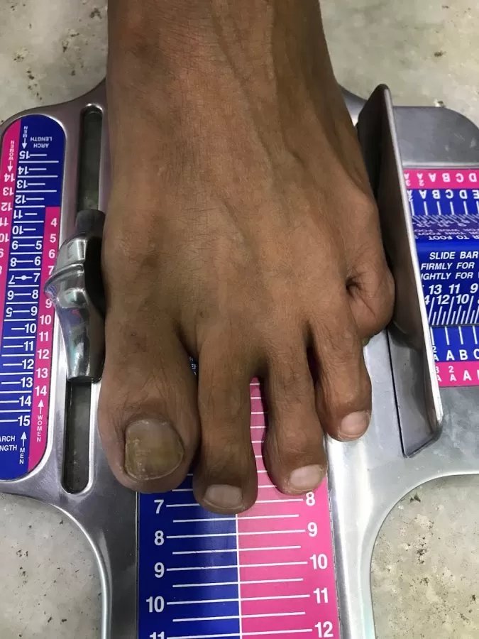 Foot Clinic & Custom made Insole in Delhi NCR | Gurugram - Noida - Faridabad - Ghaziabad - Photo 1