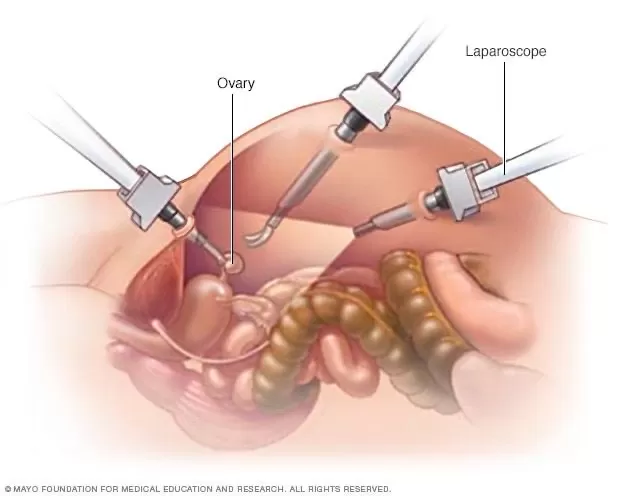 Eva IVF and Women's Care | Best Fertility Hospital in Chennai - Photo 7