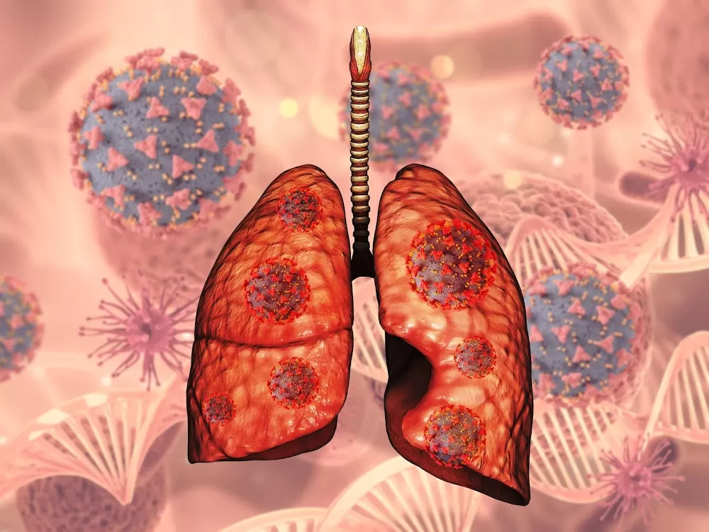 Dr. Pankaj Jain | Consult With Best Pulmonology | Respiratory Medicine Doctor Near Me | Alpha 1 Antitrypsin | 20+ Yrs. of Exp - Photo 8