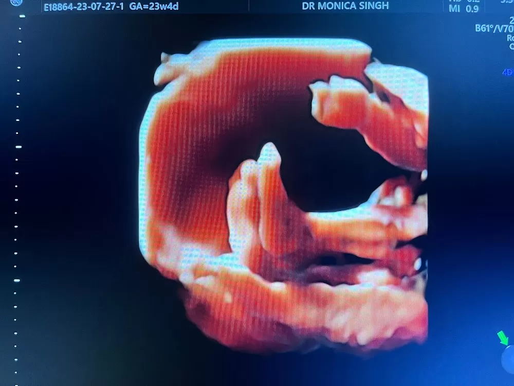 BHOPAL BEST TEST TUBE BABY, TOP IVF- SURROGACY & MATERNITY HOSPITAL - ART BANK , ENDOSCOPY CENTRE , DR MONICA-RANDHIR SINGH - Photo 3