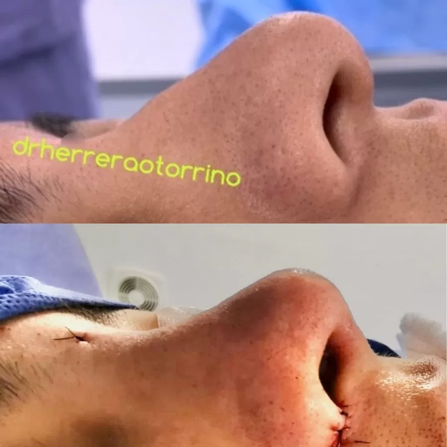drherreraotorrino - Photo 5