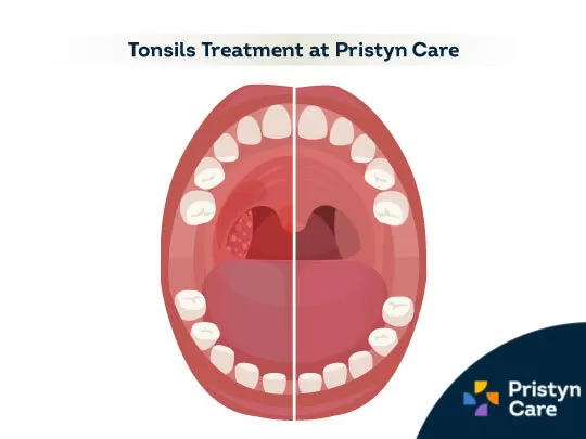 Dr. Madhusudhan - ENT Doctor | Sinusitis | Tonsillitis | Nasal Polyps | Adenoids | DNS | Mastoiditis | FESS | Tympanoplasty - Photo 2