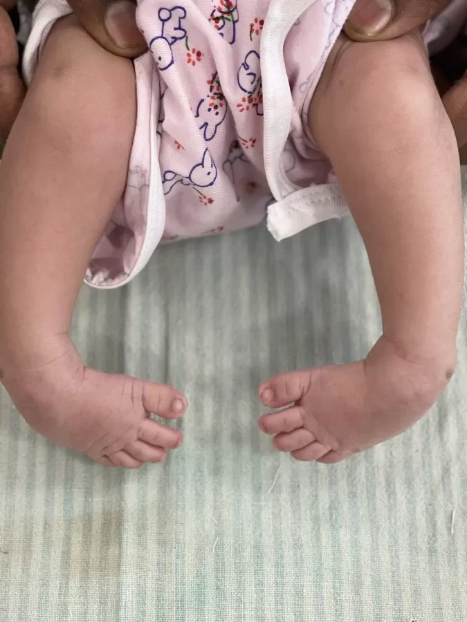 𝗗𝗿. 𝗔𝗺𝗮𝗻𝗱𝗲𝗲𝗽 𝗦𝗶𝗻𝗴𝗵 𝗔𝗷𝗺𝗮𝗻𝗶 - Best Orthopaedic Doctor in Ludhiana ( GTB Hospital ) - Photo 6