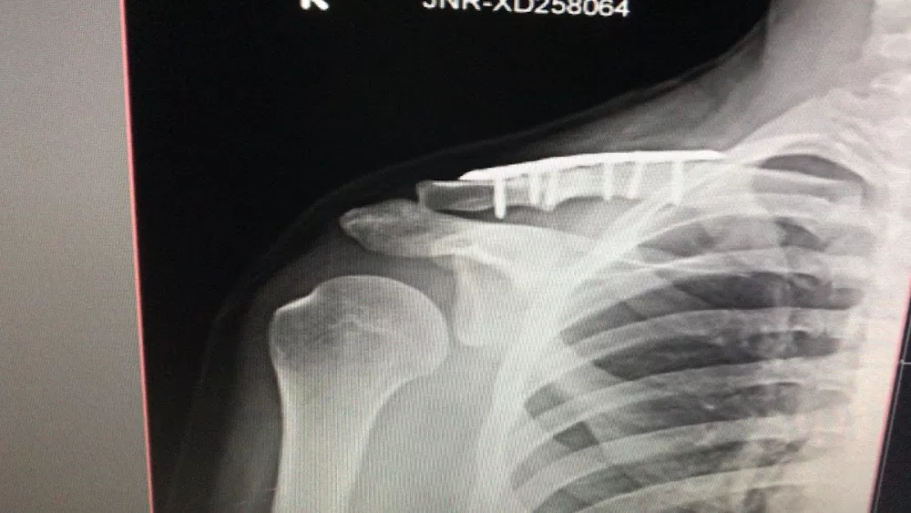 Dr Mithun N Oswal - Best Orthopedic Surgeon in Bangalore- Knee Hip Joint Replacement Surgeon in Bangalore, ACL surgery - Photo 8