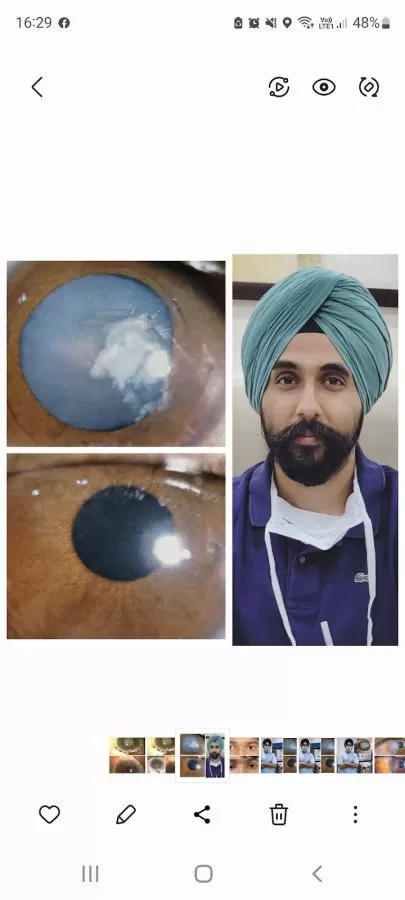 Dr. Manbir Singh - Best Cataract Surgeon, Glaucoma Expert, Lasik surgeon, Bhopal - Photo 5