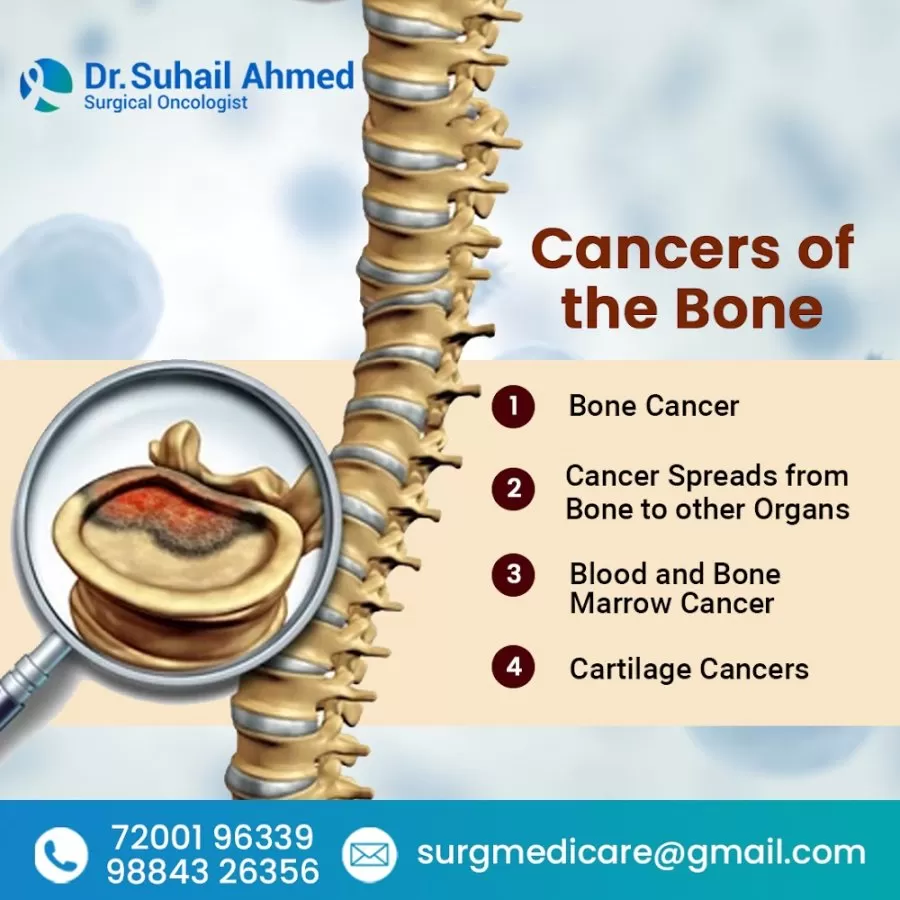 Dr. Suhail Ahmed Cancer Specialist | Oncologist in Chennai - Photo 6