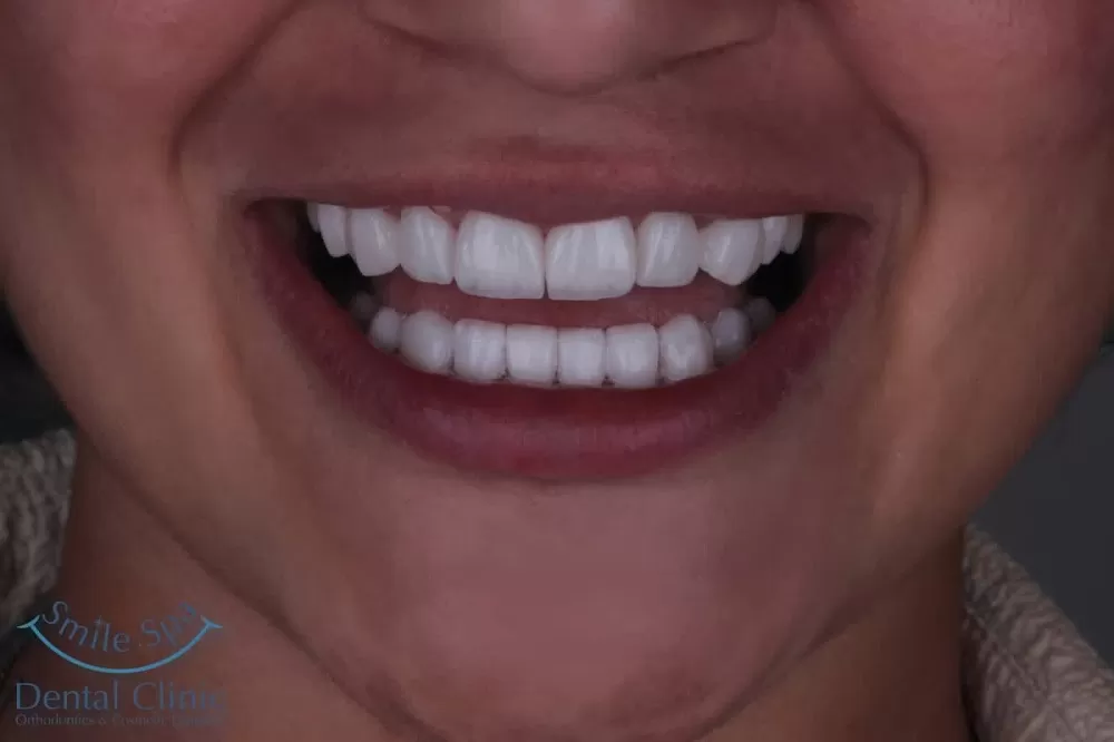 Smile Spa Clinic - Photo 6