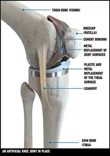 Chandra Knee Clinic - Photo 5