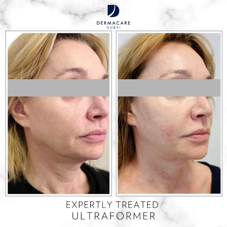 DERMACARE DUBAI - Photo 8