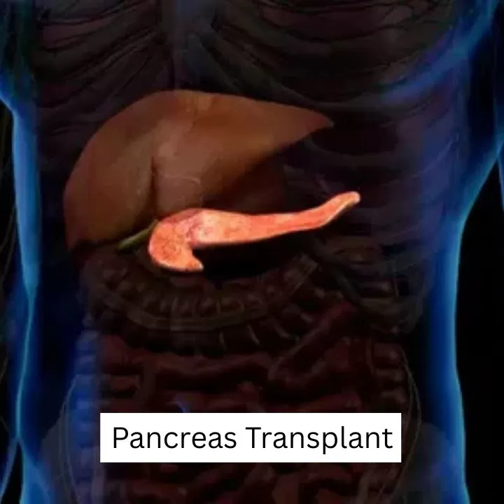 Dr. Gaurav Gupta - Liver Transplant Surgeon in Mumbai | Hepatobiliary Surgeon | HPB Surgeon| Organ Transplant Surgeon Mumbai - Photo 8