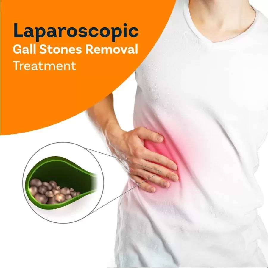 Pristyn Care DIYOS - Laparoscopy - Photo 7