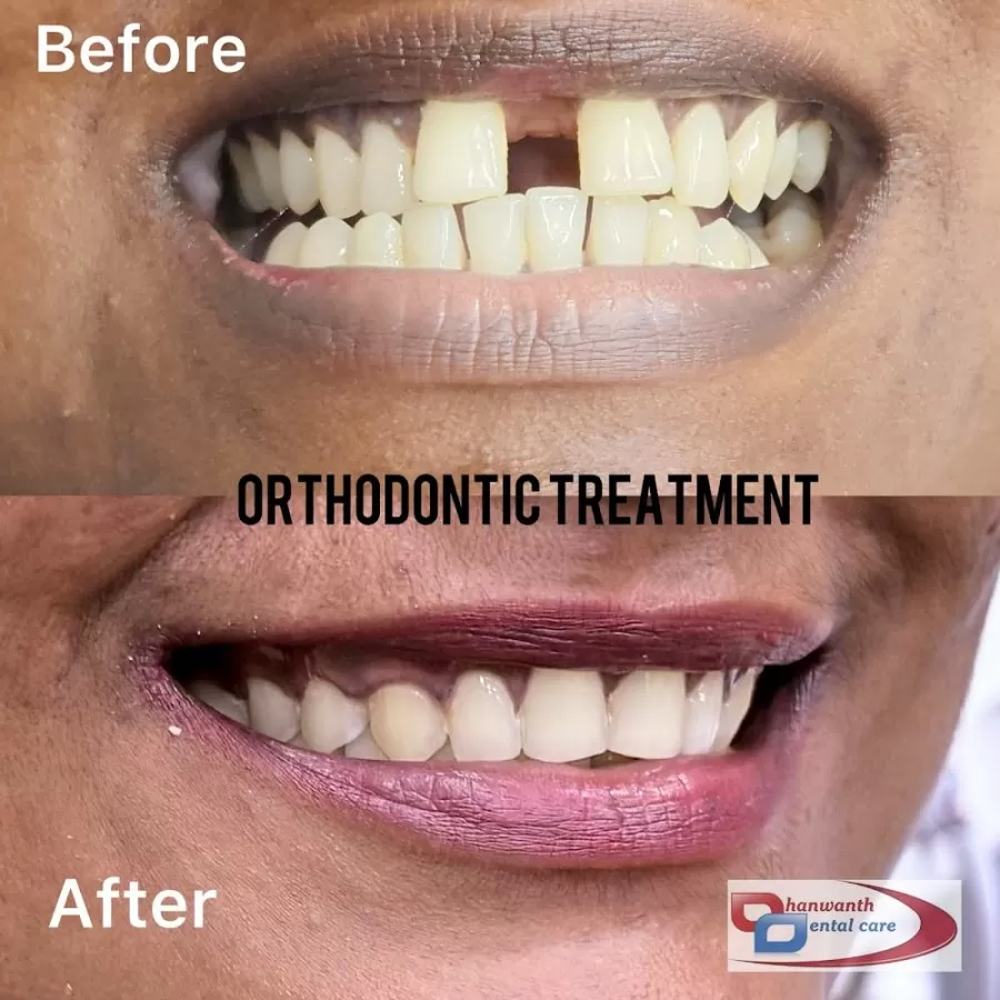 Shukra Dental Centre Mint - Photo 4