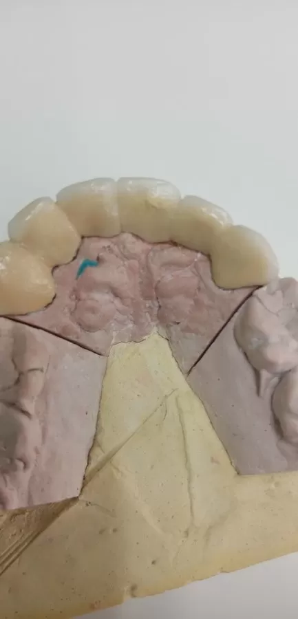 Dental universal - Photo 5