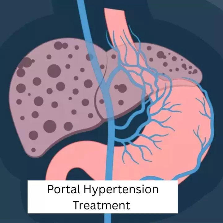 Dr. Gaurav Gupta - Liver Transplant Surgeon in Mumbai | Hepatobiliary Surgeon | HPB Surgeon| Organ Transplant Surgeon Mumbai - Photo 7