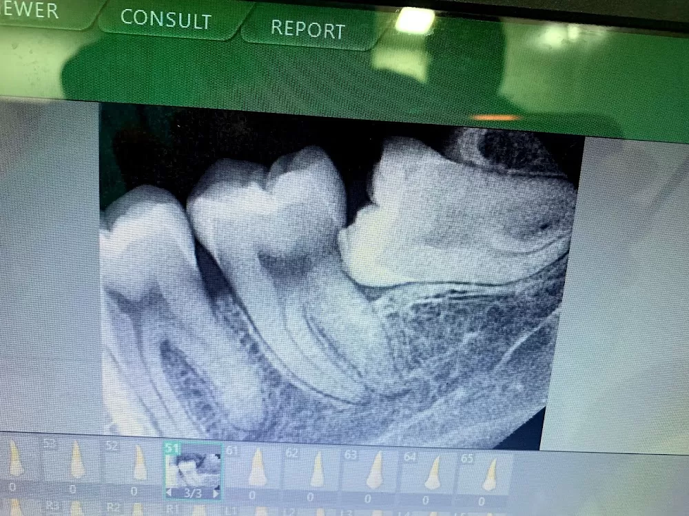 Noida Dental Hospital - Dental clinic | Dentist in Greater Noida - Photo 6
