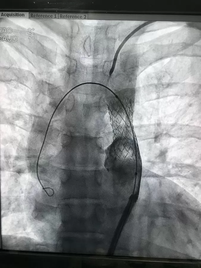 Dr. Gaurav Khandelwal - Cardiologist Doctor ! Heart Doctor ! Heart Specialist ! Tavi Tavr Expert - Photo 8