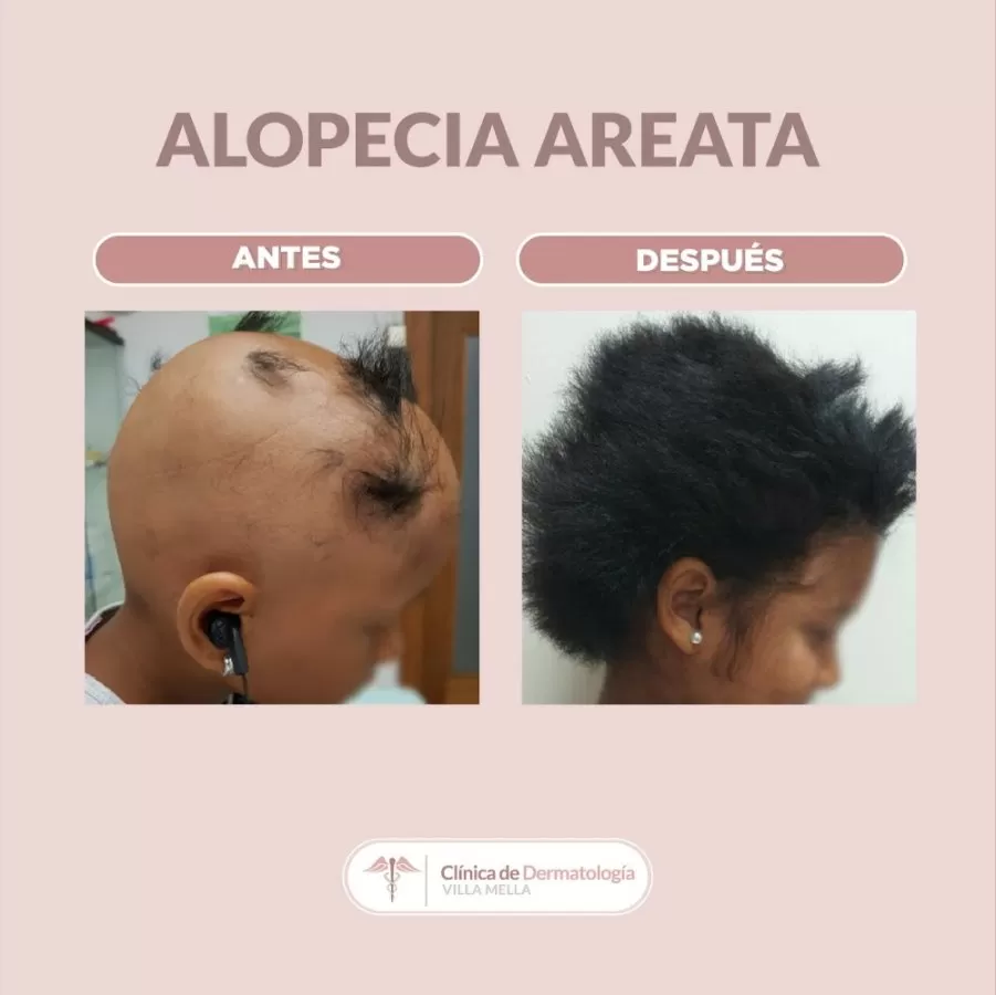 Clínica de Dermatología Villa Mella - Photo 2