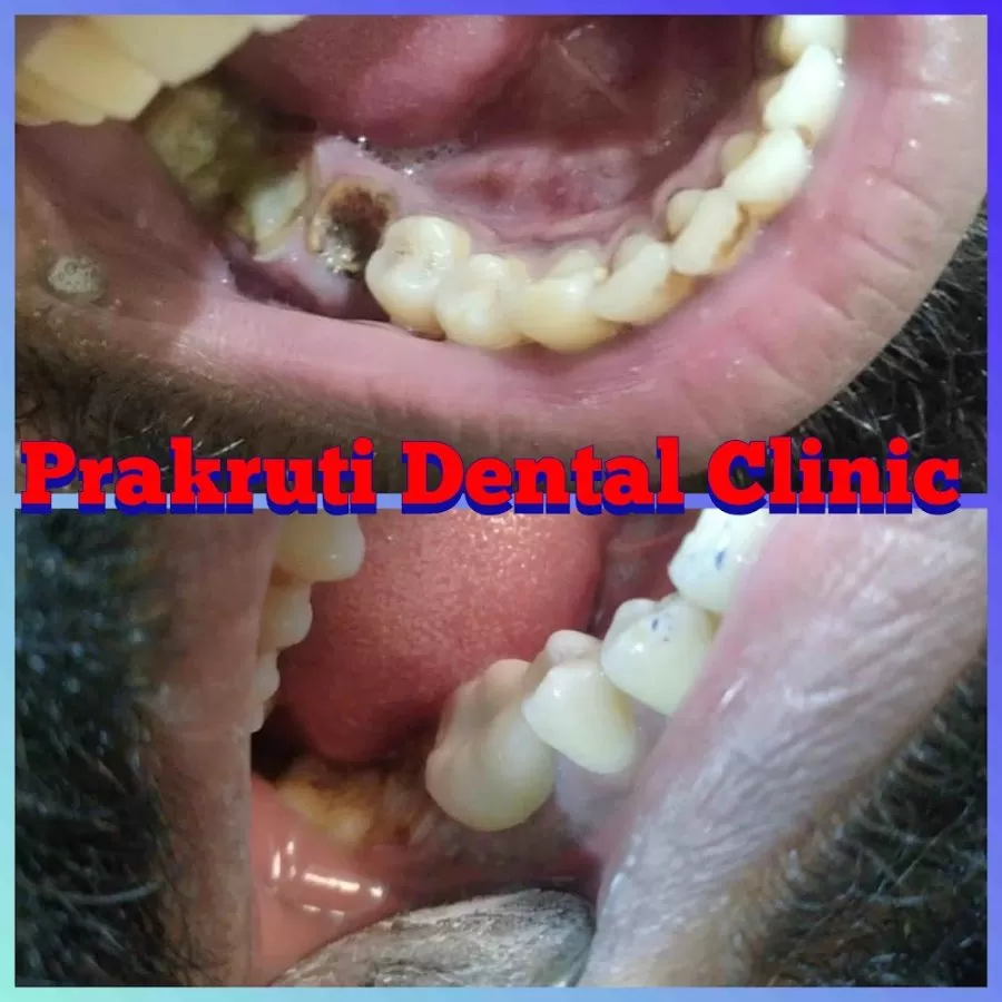 Prakruti Dental Clinic - Photo 7