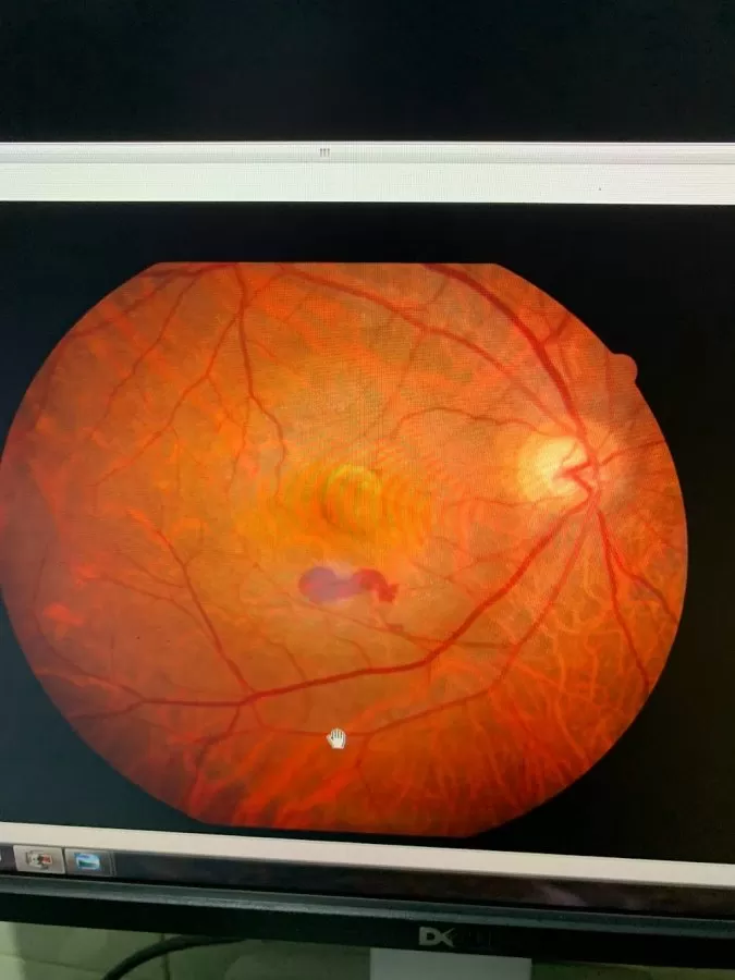 Sudhalkar Eye Hospital and Retina Centre - Photo 6