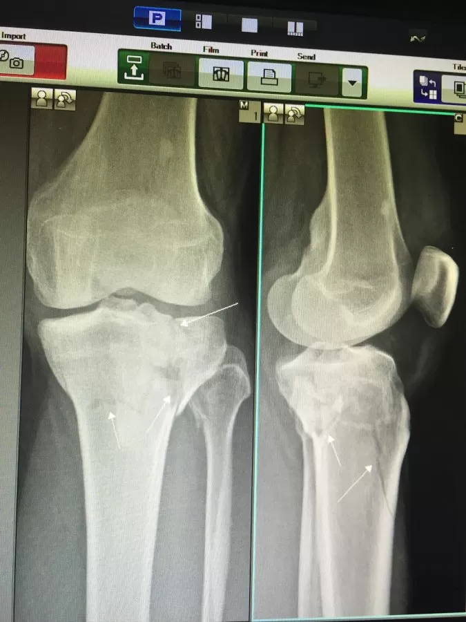 Shreeji Orthopaedic & ENT Hospital - Photo 8