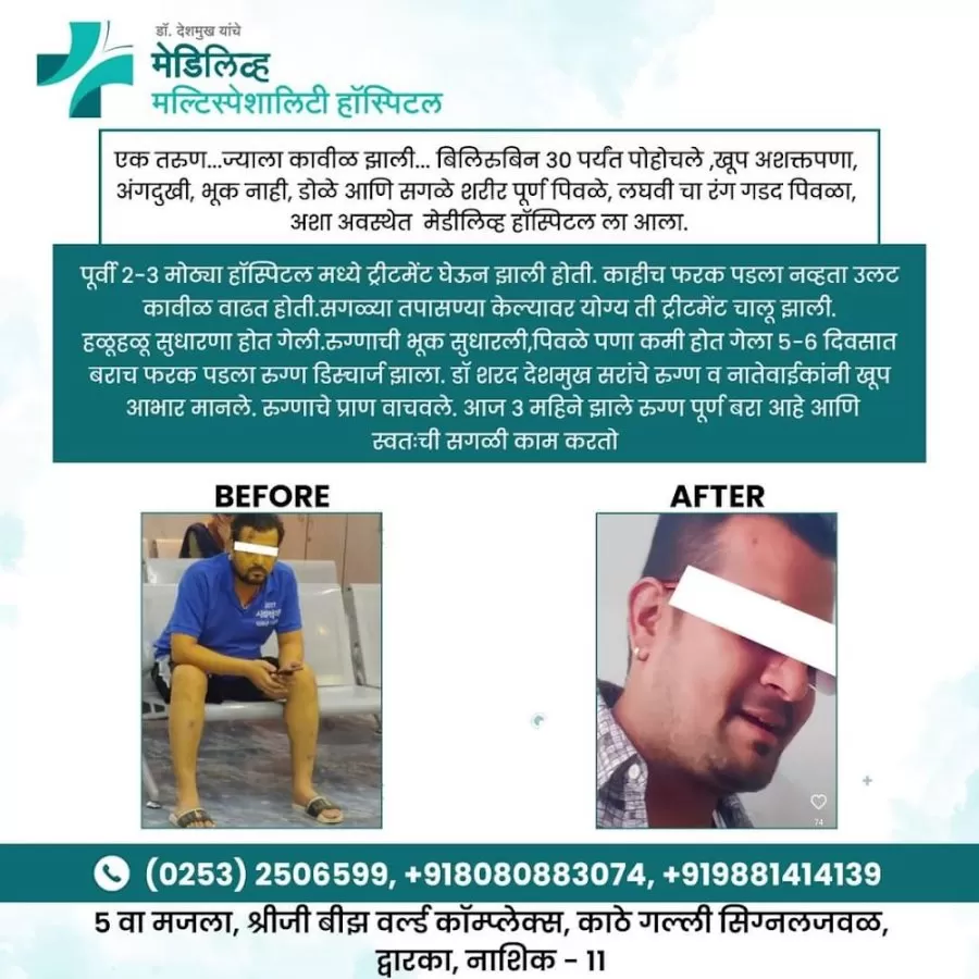 Mediliv Hospital - Advanced Piles treatment Nashik | Fissure, Fistula, Hernia, Treatment in Nashik - Photo 5