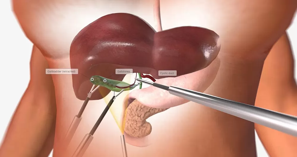 Dr U V U Vamsidhar Reddy-Consult With Best Hepatology Doctor Near Me | Hepatitis D | 10+ Yrs. of Exp. - Photo 1