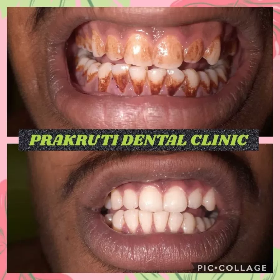 Prakruti Dental Clinic - Photo 4
