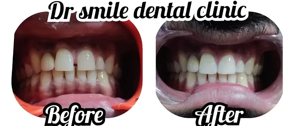 Dr smile Dental Clinic - Photo 5