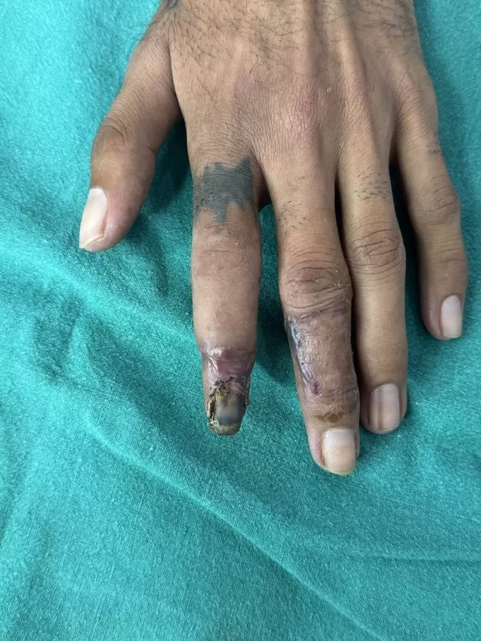 Hand Surgeon Dr Gaurav Pagare - Photo 5