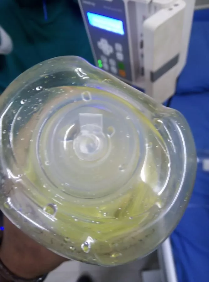 Atal Memorial Cancer Care Hospital | Cancer Treatment | Best Cancer Hospital | Cancer Specialist | Bhopal - Photo 3
