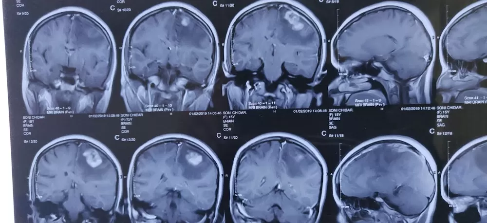 Dr. Anjeev. K. Chaurasiya - Best Neurosurgeon | Brain Tumor | Stroke | Spine Surgeon | Headache | Doctor | Bhopal - Photo 4