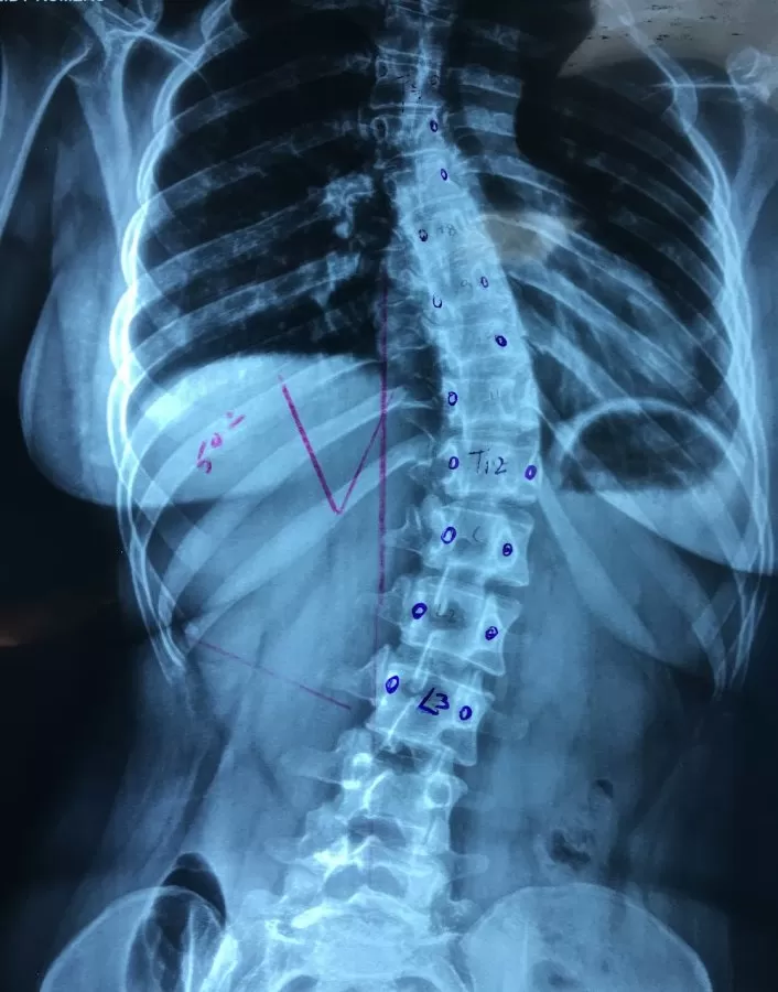 Unidad de Columna Vertebral Dr. Julio Angel García. Diagnóstico y Tratamiento. Centro Médico Dominicano - Photo 5