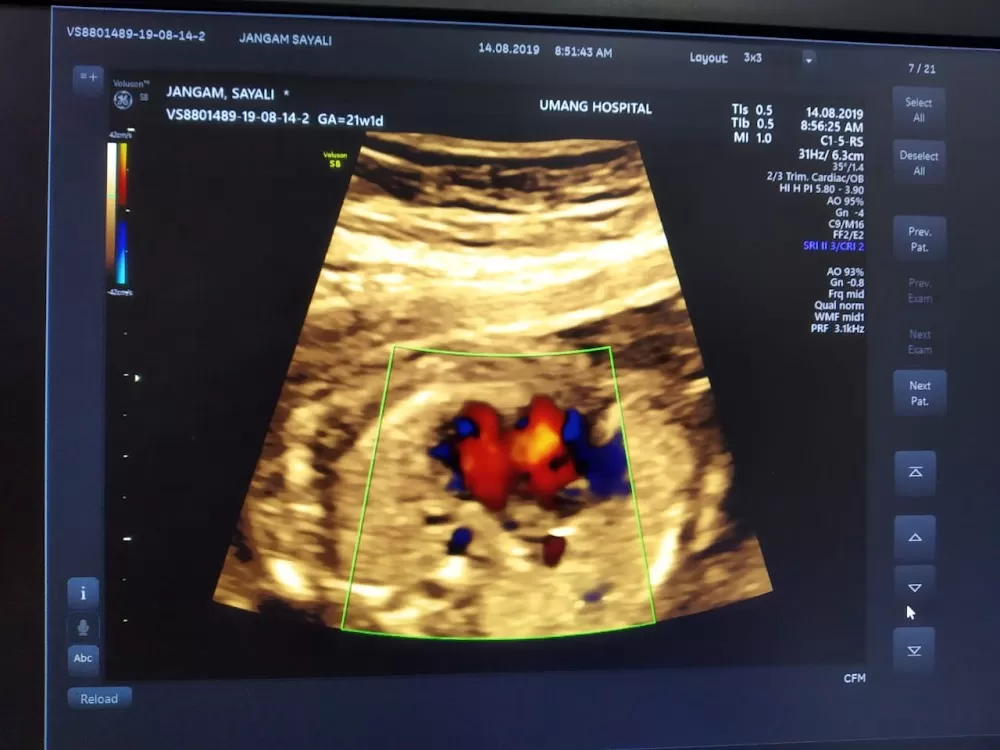 Umang Hospital-Best Lady Gynecologist in pune, Infertility specialist, Obstetrician Gynaecologist - Photo 8