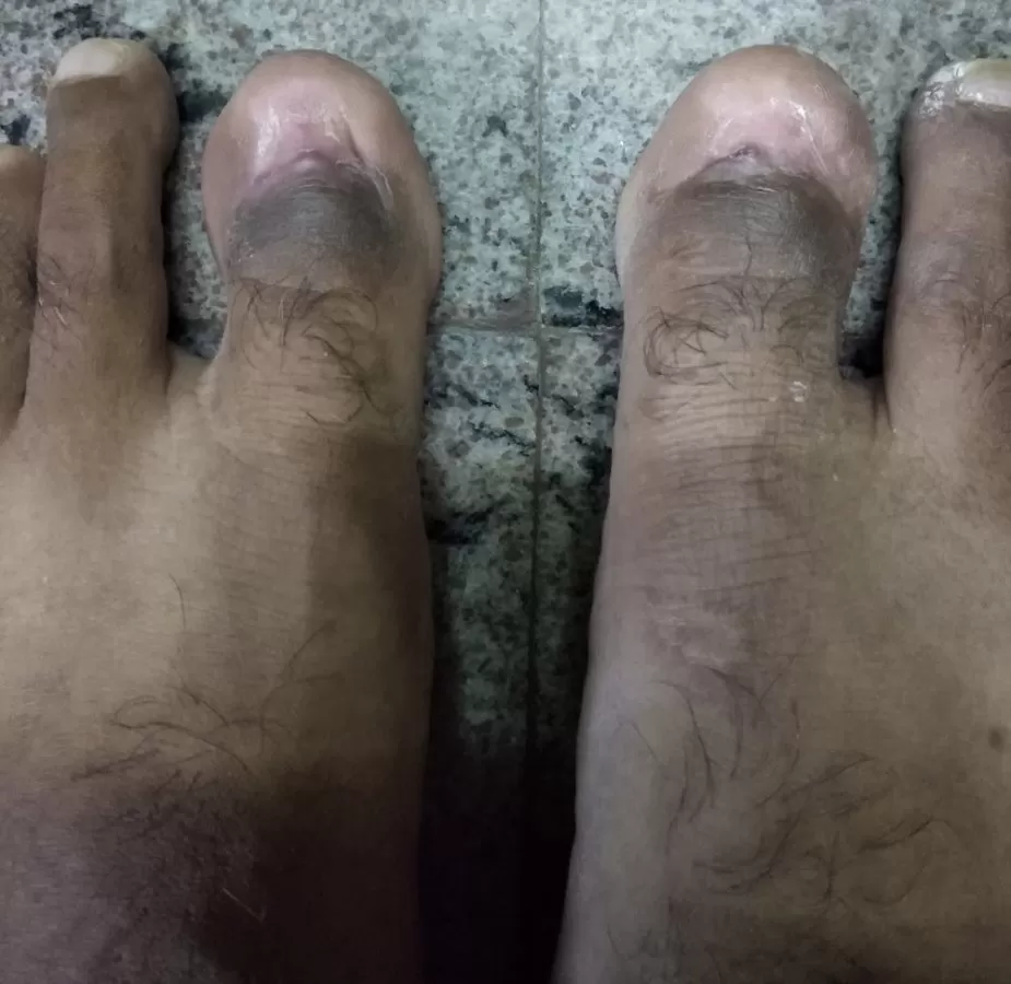 CDFC HOSPITAL-Chennai Diabetic Foot Care Centre - Photo 4