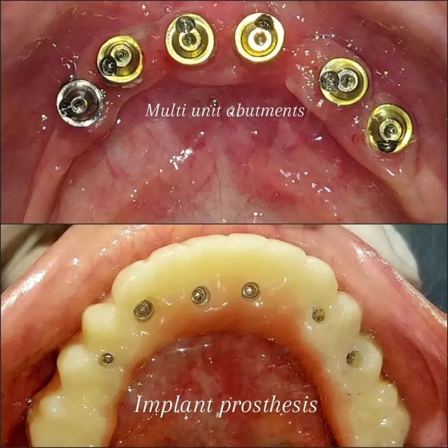 Dr. Gowds Dental Hospitals - Photo 2