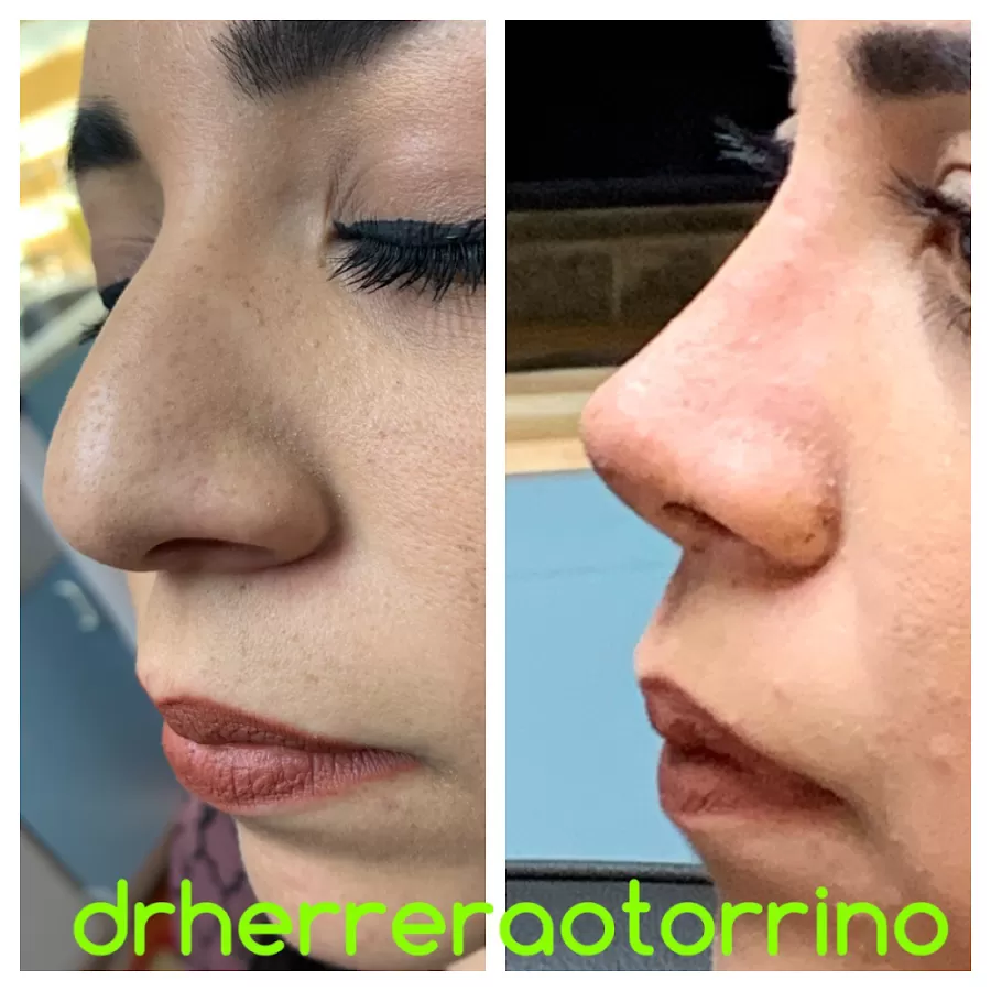 drherreraotorrino - Photo 8