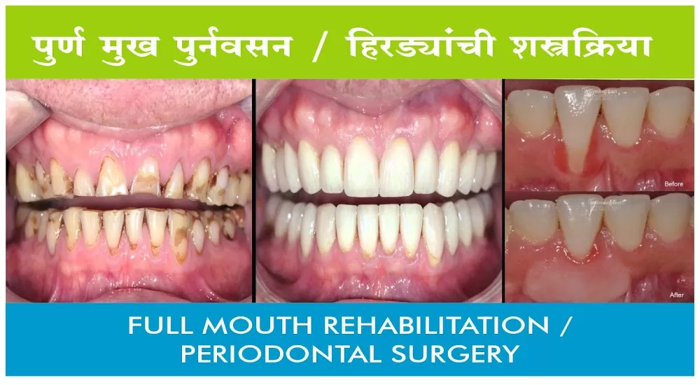 MARATHI LOKSEVA TRUST - CITY DENTAL CLINIC - Photo 8