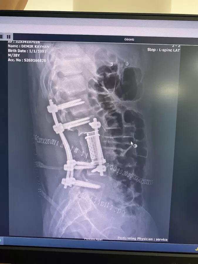 orthopedic surgery, spine surgery - Photo 4