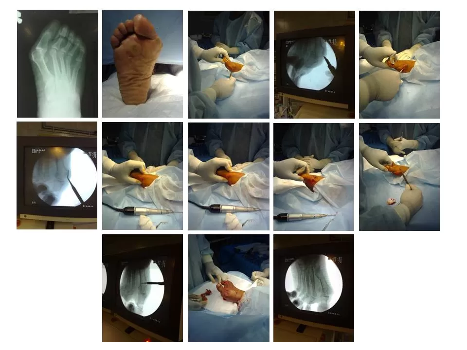 Diabetic Foot & Podiatrist - Visa Medicure - Dr.T.V.Raja - Photo 5