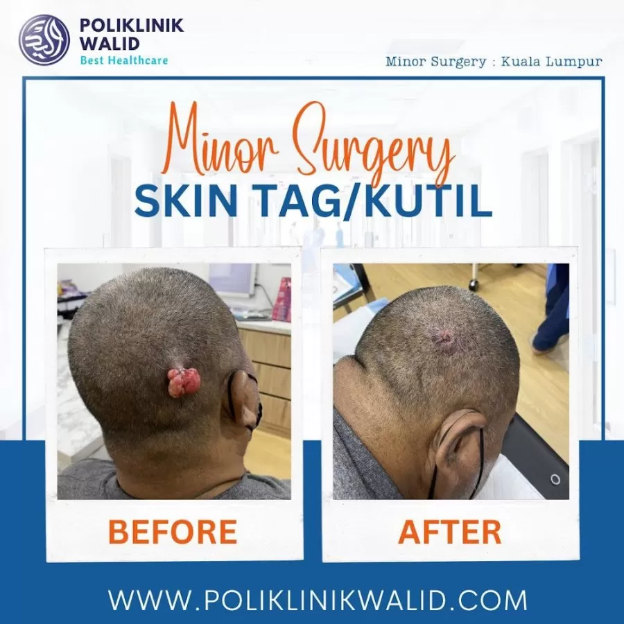 Poliklinik Walid Simpang Ampat - Photo 8