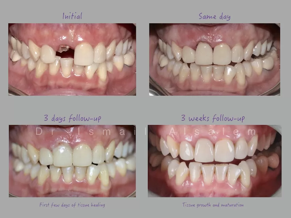 Alsalem Dental & Implant Center - Photo 3