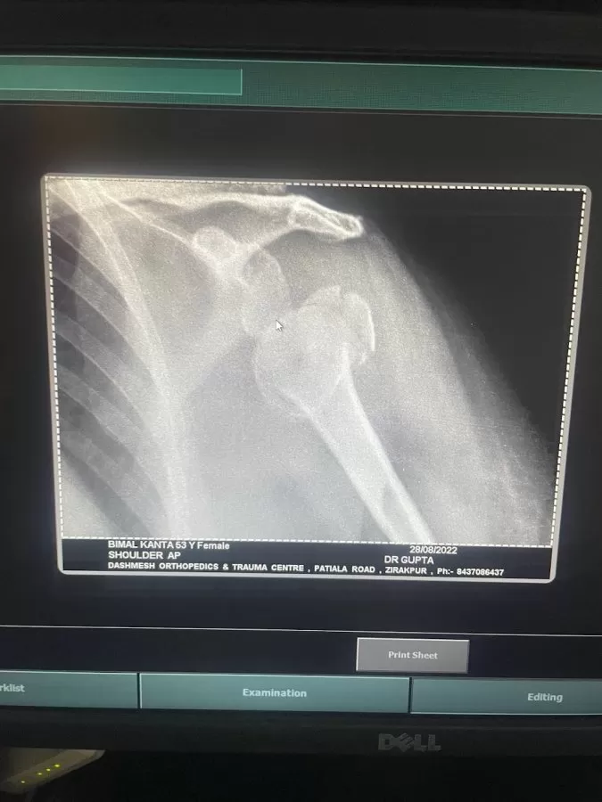Dashmesh Hospital - Dashmesh Hospital - BEST HOSPITAL | BEST ORTHOPAEDIC HOSPITAL | ORTHOPAEDIC HOSPITAL IN ZIRAKPUR - Photo 7