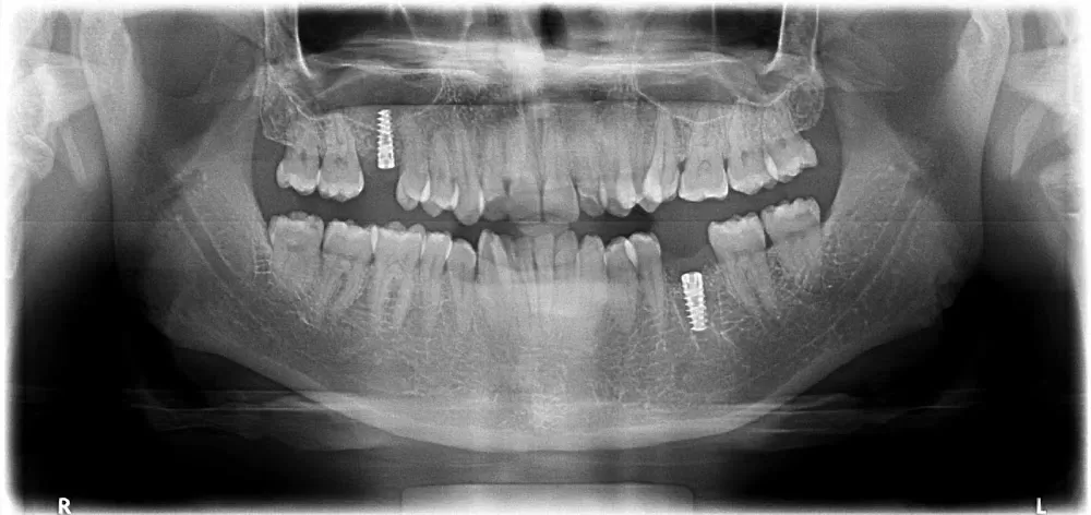 VIJAYA DENTAL - Photo 7